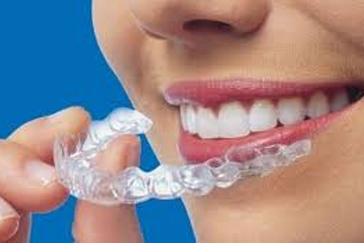 Alineadores dentales invisible